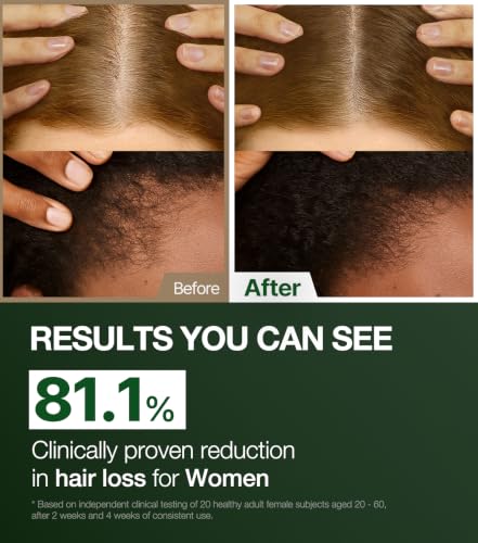 Alpha Erguen Hair Loss Treatment for Women, Vegan Conditioner for Thinning Hair, Weak Hair & Scalp Care, Pregnancy Safe Formula & Postpartum Hair Care, 500ml / 16.9 fl oz