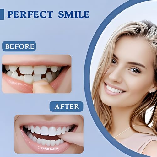 2 Pairs of Smile Adjustable Supports Unisex for Temporary Use to Quickly Restore Self-Confident Smiles