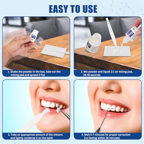 Tooth Repair Kit, Temporary Teeth Replacement Kit, Zinc Oxide Eugenol Cement Dental Kit for Broken Chipped Teeth, Missing Teeth, Crown Fillings & Bridges, Improving Smile 4 Pcs