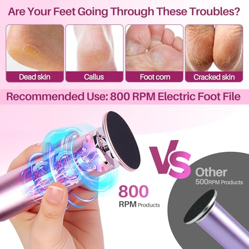 LIONVISON Electric Foot Callus Remover: Adjustable Speed Foot File Pink
