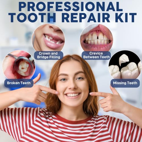 Dental Tooth Repair Kit with Zinc Oxide Eugenol Dental Cement, Temporary Filling Chips for Chipped Teeth, Loose Crowns, Cavities & Minor Tooth Repairs, Temporary Teeth Fix