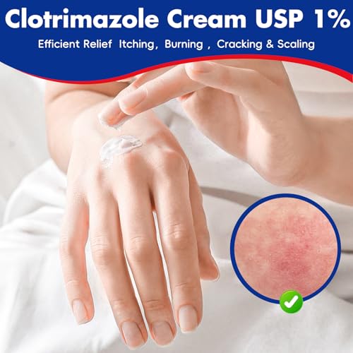 Clotrimazole Antifungal Cream 1% USP (1 oz), Anti Fungal Treatment, Relieves Itching, Burning, Cracking and Scaling Associated Athletes Foot 1 BOX