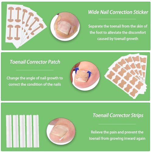 Ingrown Toenail Corrector Set, Professional Foot Care Kit for Ingrown Toenail Treatment & Removal, Toenail Straightener for Curved Pincer Thick Nails, Home Pedicure Tools for Men Women