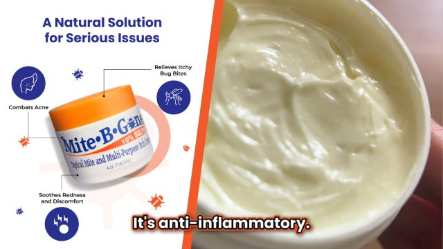Mite Treatment for Humans 2-Step Kit, Sulfur Lotion & Soap by Mite-B-Gone 2pc Set (Lotion & Soap)