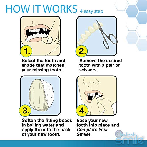 Instant Smile Complete Your Smile Temporary Tooth Replacement Kit - Replace a Missing Tooth in Minutes - Patented 40 Piece Assortment