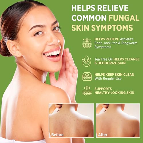 Roycederm Antifungal Bar Soap - Tea tree Oil Soap - Athlete’s Foot Treatment for Jock Itch & Ringworm - Medicated Antifungal Soap with Clotrimazole 1% - Tea Tree Oil Scent, 1 Pack 4 Ounce (Pack of 2)