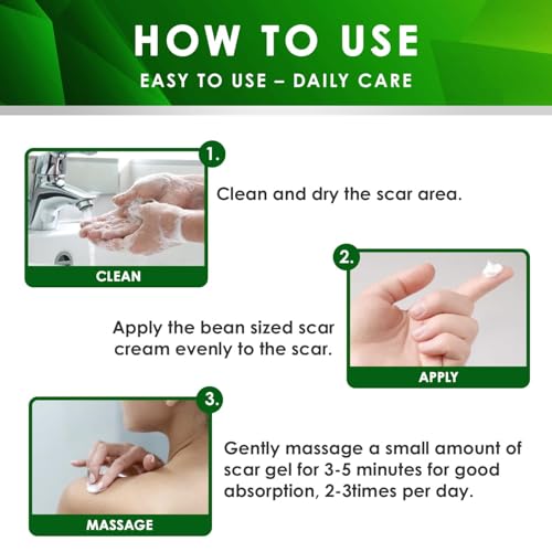 Tobcharm Advanced Keloid Bump Removal: Silicone Keloid Scar Removal Cream for Scars from Piercing, Surgical Marks, Acne, and Burns, Keloid Treatment for Ears, Face, and Body with Healing Formula 30g 1 Fl Oz (Pack of 1)