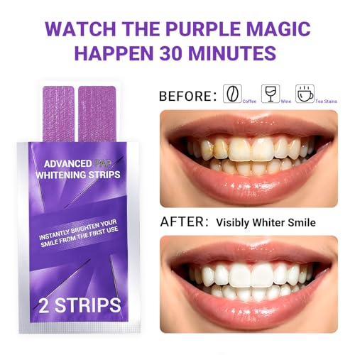 DrBioCare Pap Purple Teeth Whitening Strips for Sensitive Teeth – Peroxide Free, 20% Larger for Full Coverage, Non-Slip, Enamel Safe – Helps Remove Coffee & Wine Stains – 28 Strips (14 Treatments) 1 Count (Pack of 28)