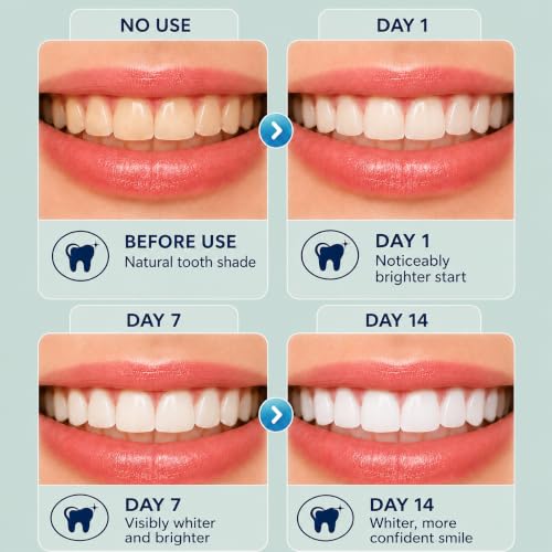 6% Hydrogen Peroxide Teeth Whitening Strips - 14 Treatments (28 Strips) - No-Slip Residue-Free - Enamel Safe Zero Sensitivity - Removes Coffee, Tea, Wine & Tobacco Stains - Cool Mint 2 Count