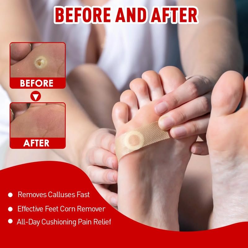 Corn and Callus Remover for Toes and Feet - Extra Strength 40% Salicylic Acid Nursing Pads-Formulated With a Safe Formula to Effectively Remove Corns and Calluses（42 Pack） - BeesActive Australia