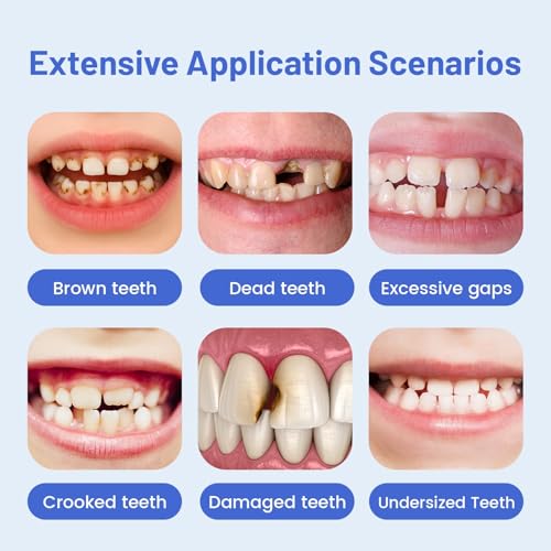 Wokyo Teeth Dental Veneers Mould Kit Light Dental Composite Resin Teeth, 32 Pcs Different Shapes Available, Heat Resistant