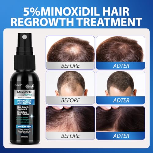 5% Minoxidil for Men Hair Loss Treatment, Minoxidil for Women Hair Growth Spray, For Men & Women, Supports Thinning Hair, With Biotin, Easy Daily Application (60ml) 1 Count (Pack of 2)
