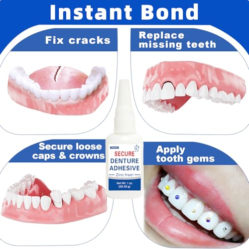 Dental Lab Instant Bonding Dental Glue (1oz), Repair Cracks & Secure Loose Teeth, Super-Strong Adhesive—Lasts Days to Weeks