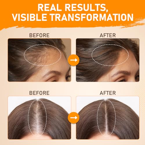 Batana Oil for Hair Growth–100% Pure Unrefined with Rosemary, Castor & Pumpkin Seed Oils, Infused with Biotin | Strengthens, Repairs Scalp, Nourishes & Reduces Hair Loss for Men & Women– 4 oz x 2 Pack