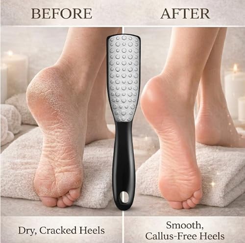 Professional Foot File & Callus Remover 2-in-1 Set for Seniors and Adults –9.6" Foot Rasp with 6.7" Nail File – Elegant Black– Durable & Hygienic Pedicure Tool for Smooth, Soft Feet–Wet & Dry Use