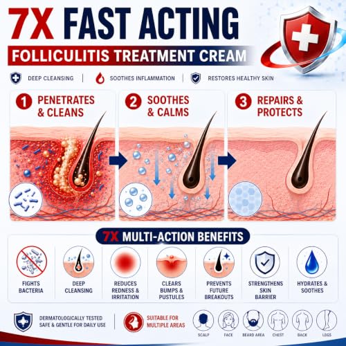 Benzoyl Peroxide Folliculitis Cream, Anti Itch Cream Extra Strength, Fast-Acting Acne Cream for Folliculitis, Razor Bumps & Ingrown Hair, Itch Cream, Psoriasis Scalp Treatment, 3.53 Oz