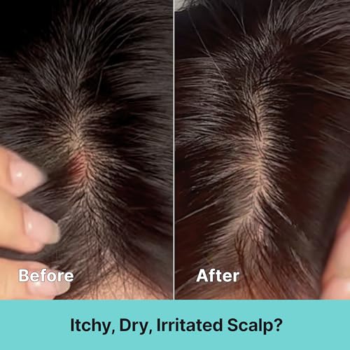 Kelp Scalp Treatment Spray for Itchy & Sensitive Scalp – Soothing Care Essence for Irritated Scalp, Lightweight Korean Leave-In Hair Treatment, 80ml