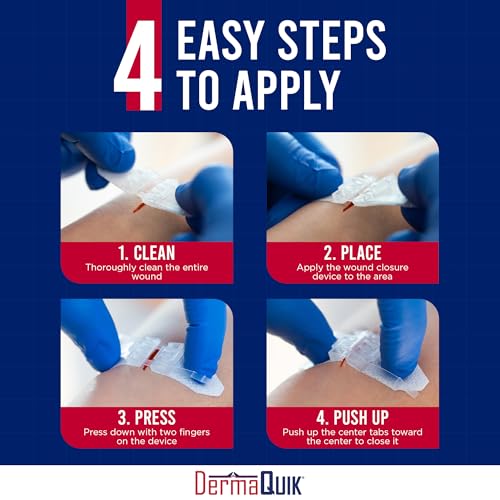 Home & Field Wound Closure Strips by DermaClip – 3 Pack Patented Laceration Strips, Upgrade from Small Butterfly Bandages for Wound Closure, Breathable, Zip Stitchless Kit Home 3 Pack