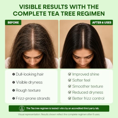 Botanic Hearth Tea Tree Hair Oil For Hair Growth - 6.7 Fl oz Set of 2 6.7 Count (Pack of 2)