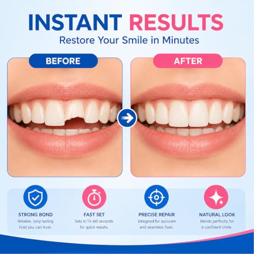Dental Lab Instant Bonding Dental Glue for Dentures & Lab Tools, 1oz