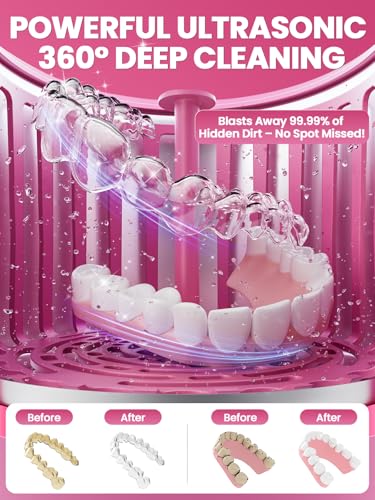 Dental Ultrasonic Retainer Cleaner Machine: Nicwell 200ML Dental Cleaning Pod for Denture, Mouth Guard, Night Guard, Braces, Tray, Aligner 45kHz Cleaner with Protection Design & Digital Timer Pink