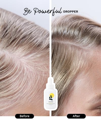 Ginger Milk Hair Growth Serum with Ginger Root and Biotin, 4 fl oz 4 Count (Pack of 1)