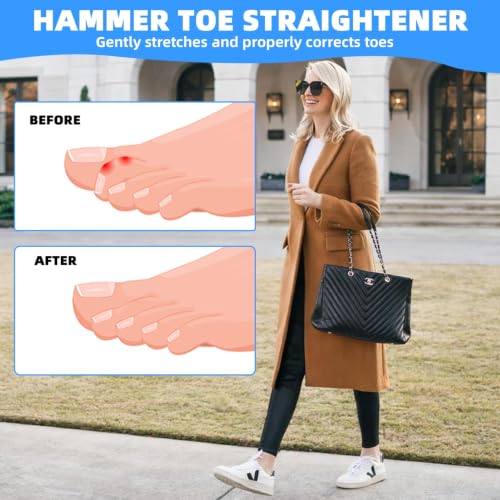 4PCS Hammer Toe Straightener, Toe Splints for Straightening, Hammer Toe Corrector for Women, Hammertoe Straightener with 2 Aluminum Plate, Toe Straighteners for Curled Toes, for Walking& Rest(Black) Black 4