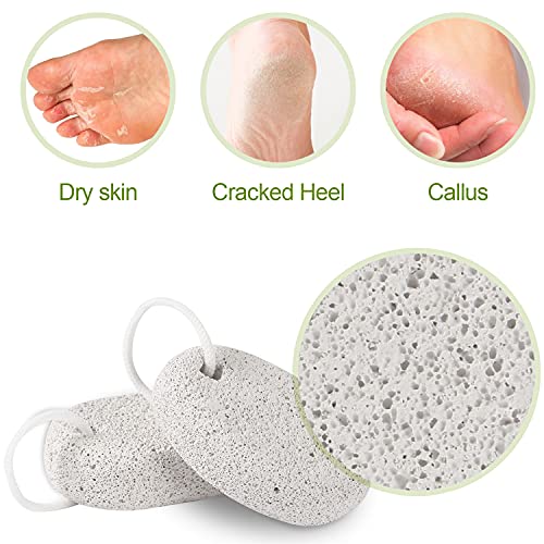 2PCS Natural Pumice Stone, Asqraqo Lava Pedicure Tools Hard Skin Callus Remover for Feet and Hands - Foot File Exfoliation to Remove Dead Skin, and Callusess 2 Count (Pack of 1)