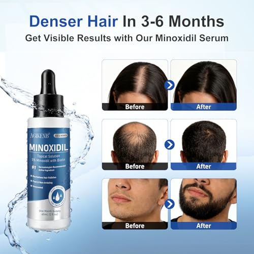 8 Pack 5% Minoxidil Hair Regrowth Serum for Men & Women, Biotin-Enriched Liquid Solution for Thicker, Fuller Hair and Beard, Extra Strength, 8 Month Supply