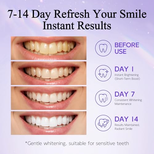 Teeth Whitening Kit