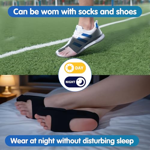 2 Piece Bunion Corrector for Women and Men, Side Adjustable Removable Design, Big Toe Straightener for Bunion Relief, Adjustable Day/Night Support (L) L