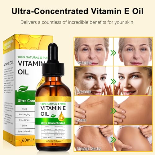 flasture Vitamin E Oil 75,000 IU – 100% Pure Natural Vitamin E for Skin, Face, Hair, Scars – Deep Moisturizing Body Oil for Dry Skin, Wrinkles – Cold-Pressed, Non-GMO,Skincare – 2 Fl Oz 2 Fl Oz (Pack of 1)