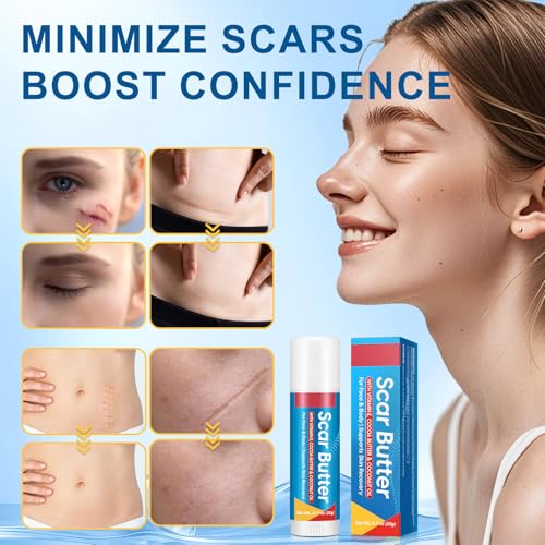Scar Stick, with Vitamin E, Cocoa Butter & Coconut Oil, 5-in-1 Skin Nourishing Formula, Effectively Reduces Appearance of Scars & Fine Lines, Skin Recovery Support, Pack of 2 0.7 Ounce (Pack of 2)