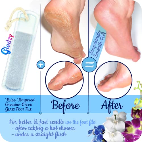 GLADZY Czech Glass Foot File Callus Remover – Double Sided Etched, Different Grit Coarse & Fine Surfaces for Hard Skin & Cracked Heels, Professional Pedicure Tool, Washable Reusable, Made in EU Medium
