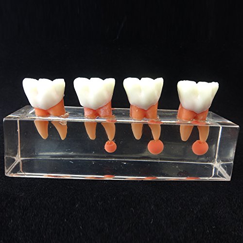 Dental Teeth Model 4-Stage Endodontic Treatment Model for Studying and Teaching …