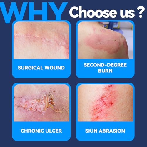 FRESINIDER Silicone Wound Contact Layer 4” x 3”, 10 Pack Non-Adherent Silicone Dressing for Gentle Removal, Protects Fragile & Sensitive Skin, Ideal for Surgical Wounds, Burns, Ulcers, Skin Tears
