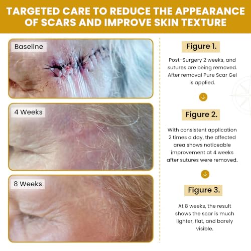 DermAvance Pure Scar Care - Silicone Scar Cream for Surgical Marks - 30g