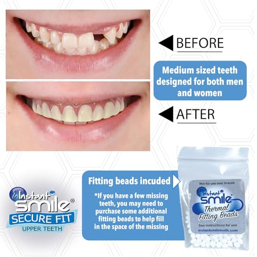 Instant Smile Secure Fit Upper Teeth Veneer -
