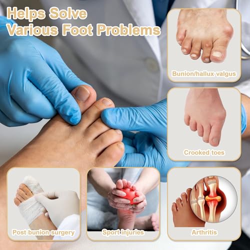 SPRING SEAON 2-Pack Bunion Corrector Adjustable Toe Splint Day/Night Beige