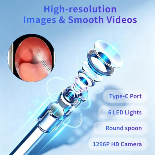 Tonsil Stone Remover with Camera, 1296P Visual Tonsil Stone Removal Kit with 6 LED Lights, 4 Interchangeable Tips, Tongue Depressor and Irrigator, WiFi App for iPhone and Android, Rechargeable