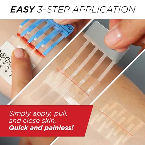 Clozex Emergency Wound Closure Bundle, Skin Closure Device for Laceration Repair Without Stitches – Treat 5 Individual Wounds, Combine for Up to 7 1/4" Total Length