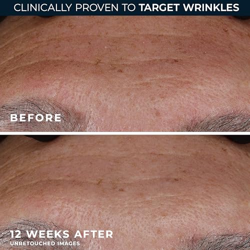 RoC Retinol Correxion Deep Wrinkle Retinol Face Serum, Ascorbic Acid, 1 0z Deep Wrinkle Serum