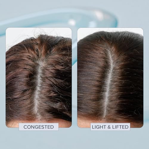 TRUHAIR Head Start Scalp Ampoule | Multi-Action Exfoliating & Nourishing Scalp Treatment | Salicylic Acid, Black Willow Bark & Biotin | Soothes, Hydrates & Reduces Flakes | 150ml/ 5.07 fl oz