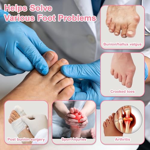 SPRING SEAON 2-Pack Bunion Corrector Adjustable Toe Splint Day/Night Pink
