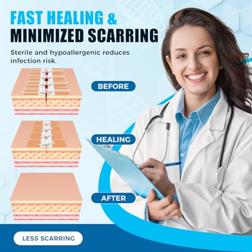 Wound Closure Device 4 Pcs - Zip Sutures & Butterfly Bandage | Stitchless Wound Repair, Rapid Hemostasis for Hiking, Camping, Wilderness Survival | Outdoor First Aid Essentials Non-woven 4 PCS