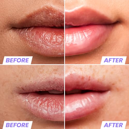 Wonderskin 3-in-1 Lip Scrub Exfoliator & Moisturizer, Lip Exfoliator Scrub, Hydrating Balm with Lip Rehab Serum Oil, Hydrating and Moisturizing (Clear)