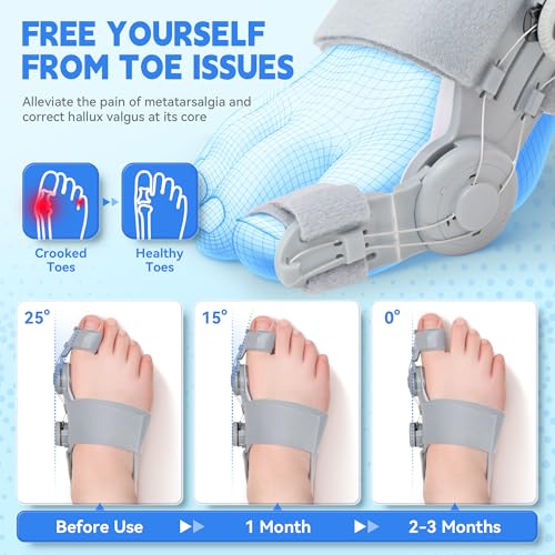 Bunion Corrector for Women & Men, Adjustable Knob Bunion Relief Orthopedic Toe Straightener with Silicone Pad Comfortable & Supportive