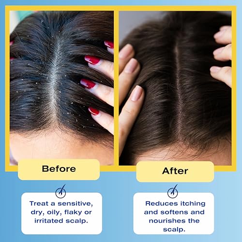 Mediceuticals Therapeutic Conditioner – All Skin Types – Sensitive Dry Scalp – Oily Scalp - Reduces Itching - Flaky Scalp 8.45oz (250ml)