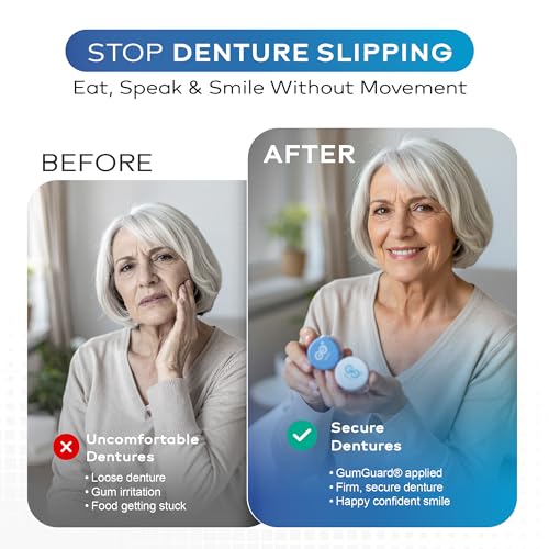GumGuard Denture Putty Pack Reline Set (Pack of 4) – Fast Self-Curing Denture Reliner for Custom Fit & Comfort | Versatile Denture Reline Kit with Watertight Seal & Multiple Applications 4 Pack