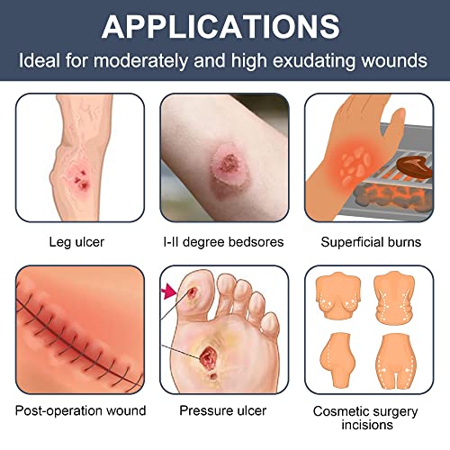 LotFancy Calcium Alginate Wound Dressing, 4"x 4" Non-Stick Pads for Wounds 4"x 4" (10-Count)